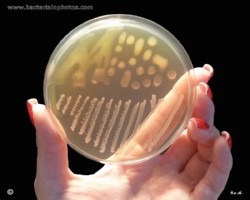 streptococcus equi ssp. zooepidemicus and streptococcus agalactiae colony morphology comparison